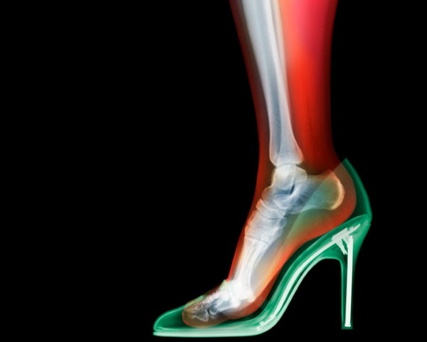 nick veasey x ray fashion photography