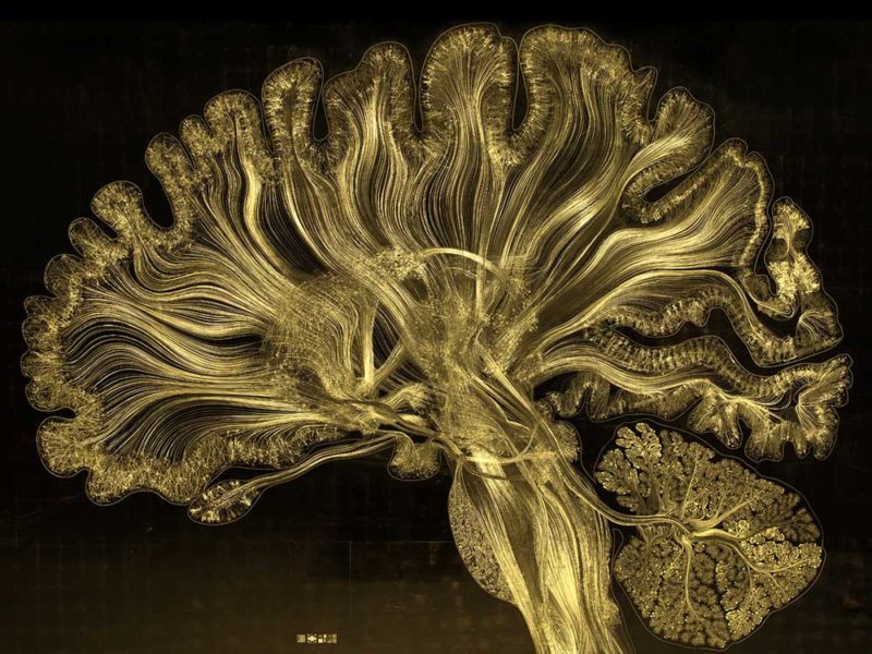 gold leaf prints of the human brain by greg dunn