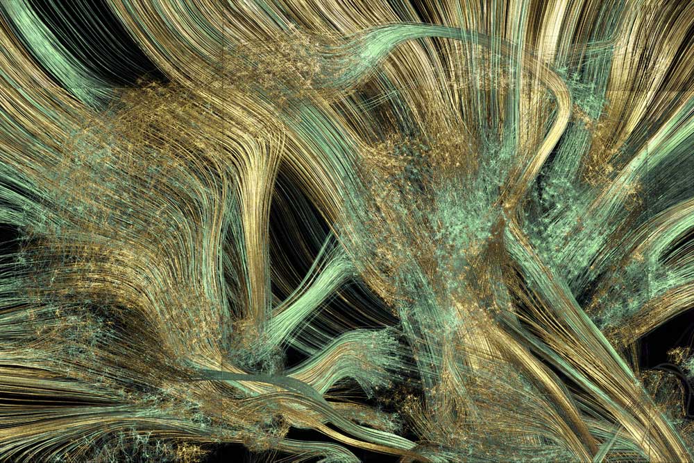 gold leaf prints of the human brain by greg dunn