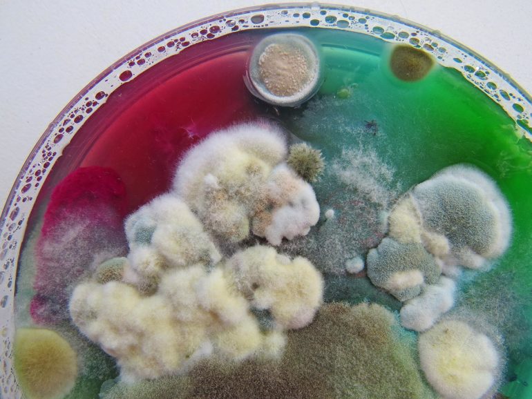 When Mold is looking Fabulous! The Microorganisms Studies of Dasha Plesen